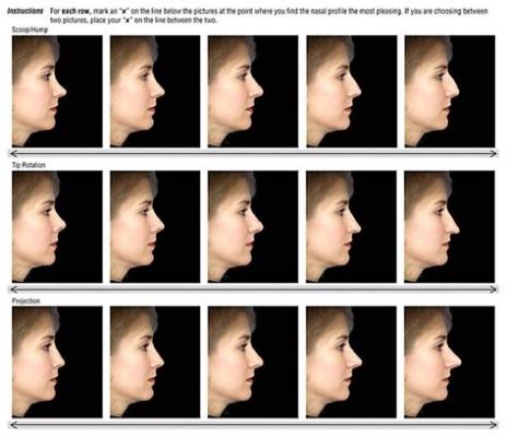 What Animal Has the Biggest Nose? And Why Do We Even Care About Nose Sizes?